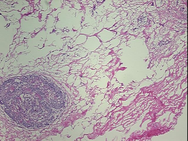 4x Image