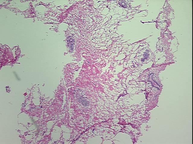 4x Image