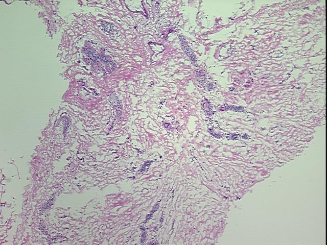 4x Image