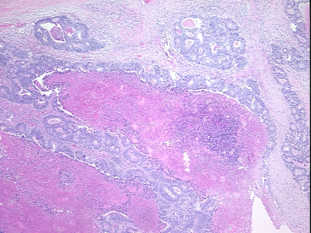 4x Image