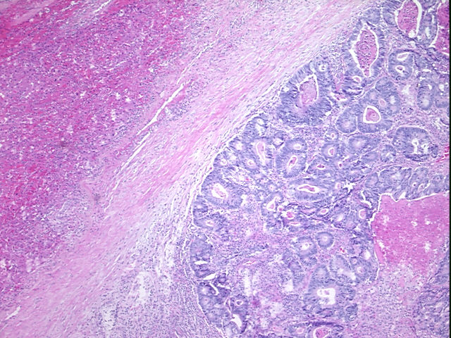 4x Image