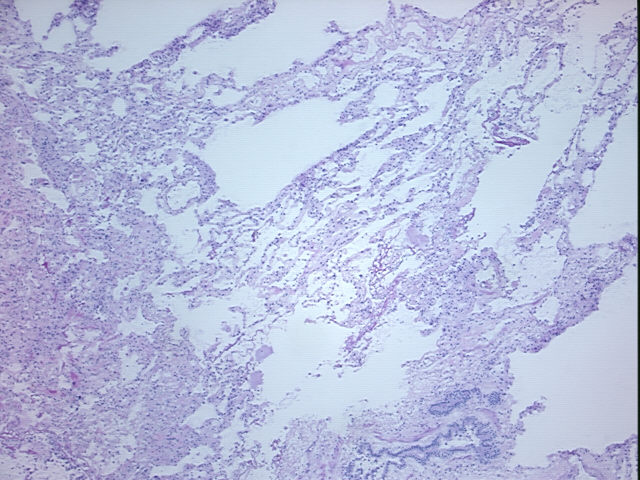 4x Image