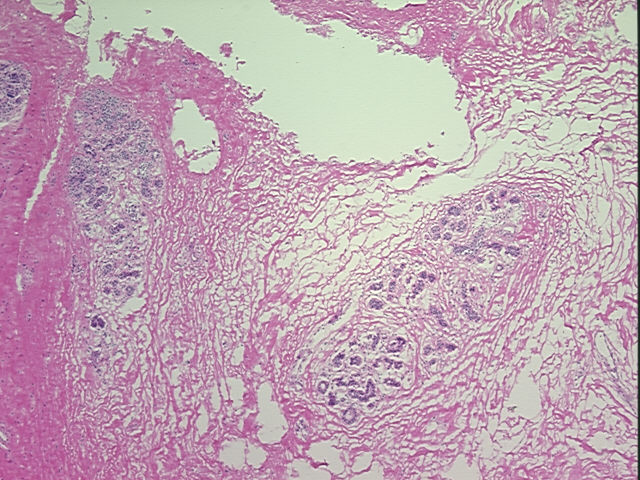 4x Image