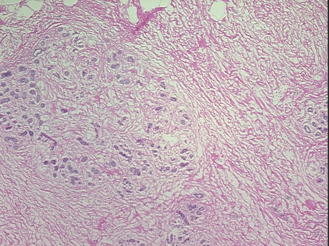 4x Image