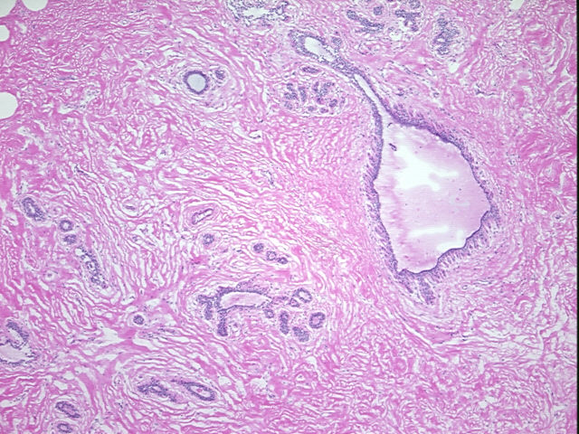 4x Image