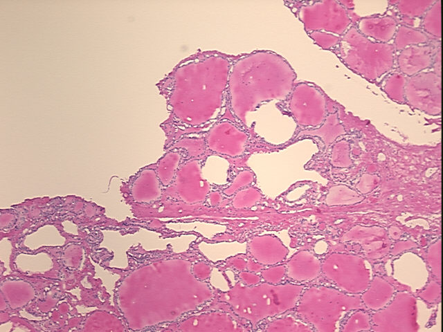 4x Image