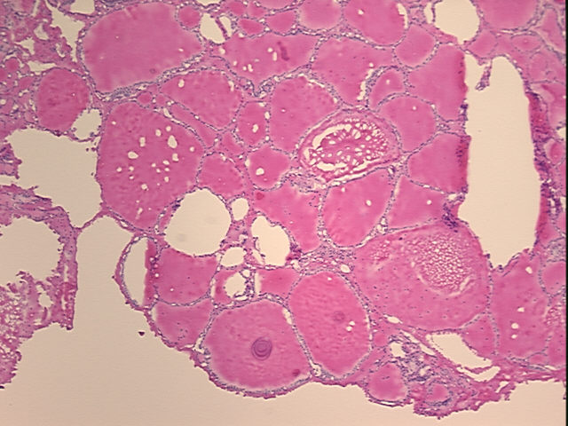 4x Image
