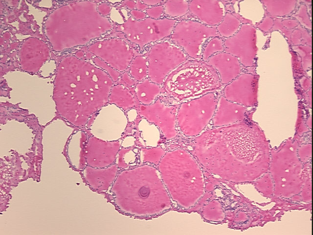 4x Image