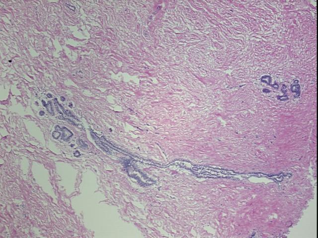 4x Image