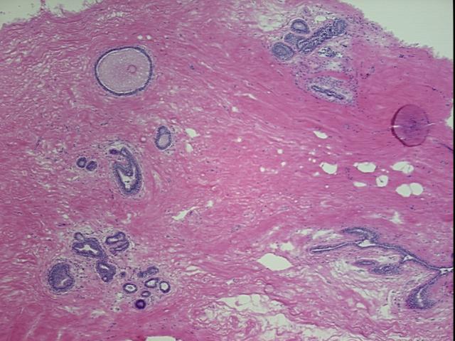 4x Image