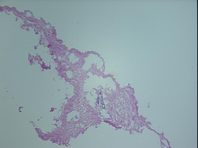 4x Image