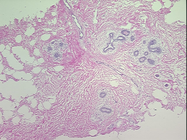 4x Image