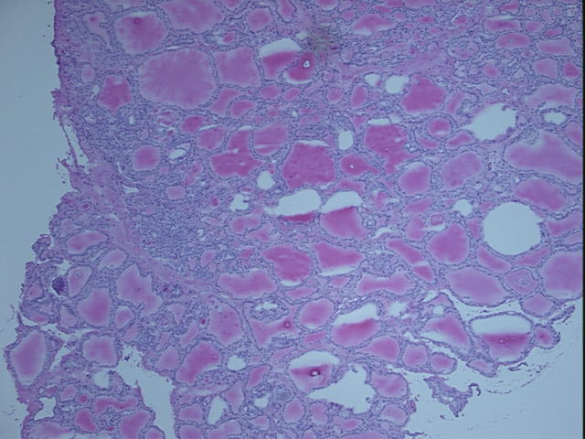 4x Image