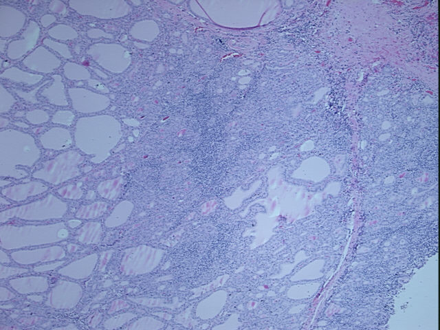 4x Image