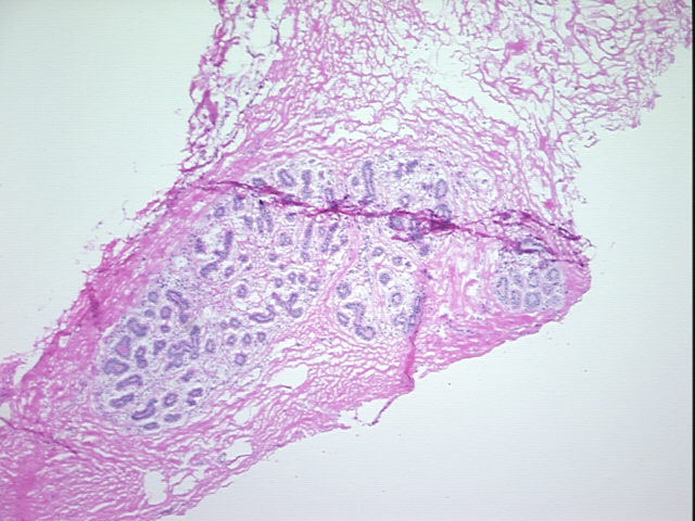4x Image
