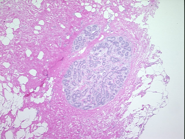 4x Image