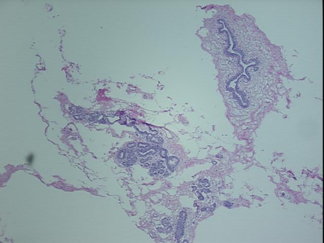 4x Image