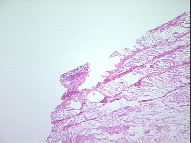 4x Image