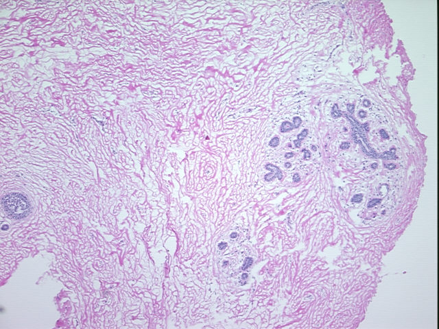4x Image