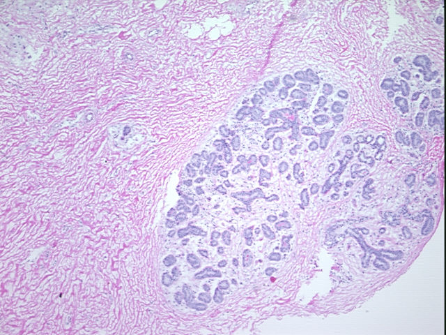 4x Image