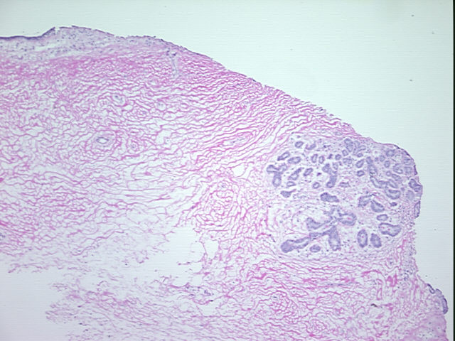 4x Image