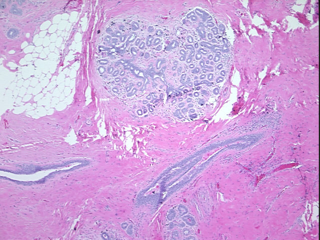 4x Image