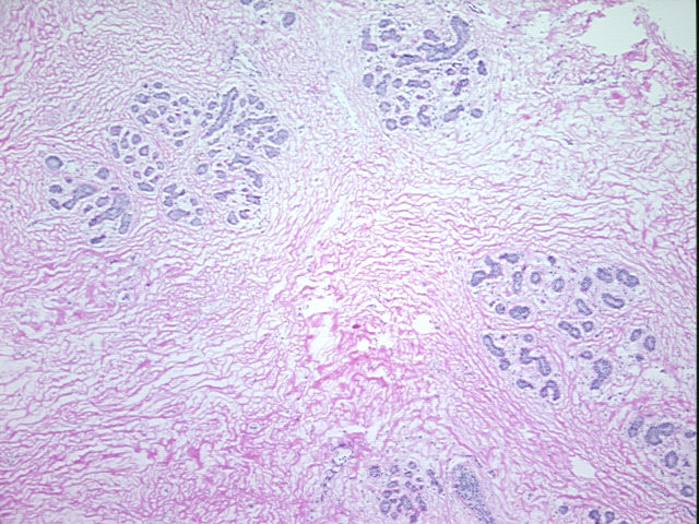 4x Image