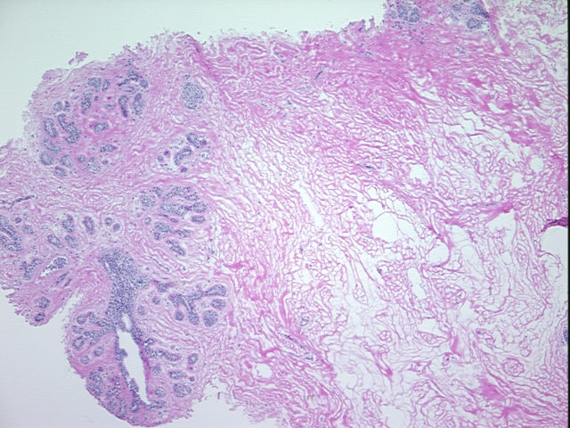 4x Image