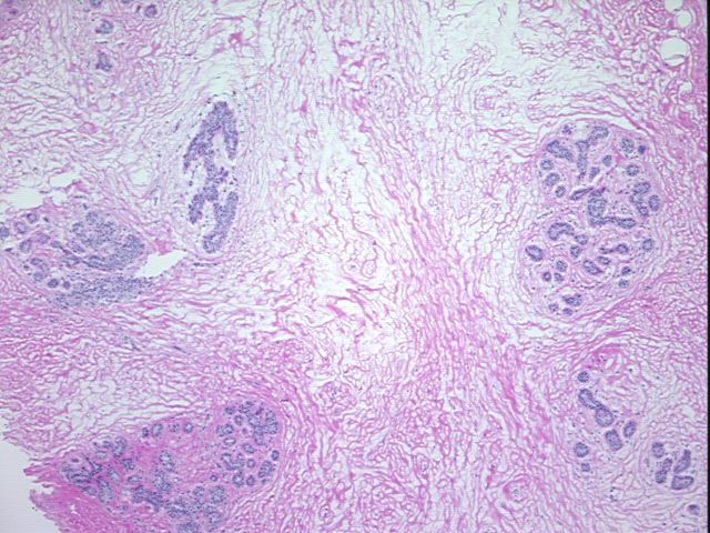 4x Image