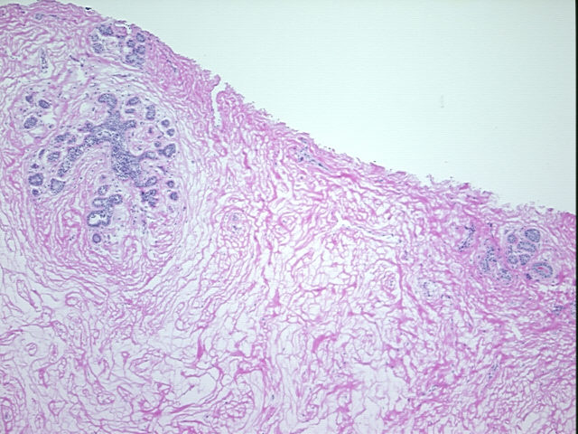 4x Image