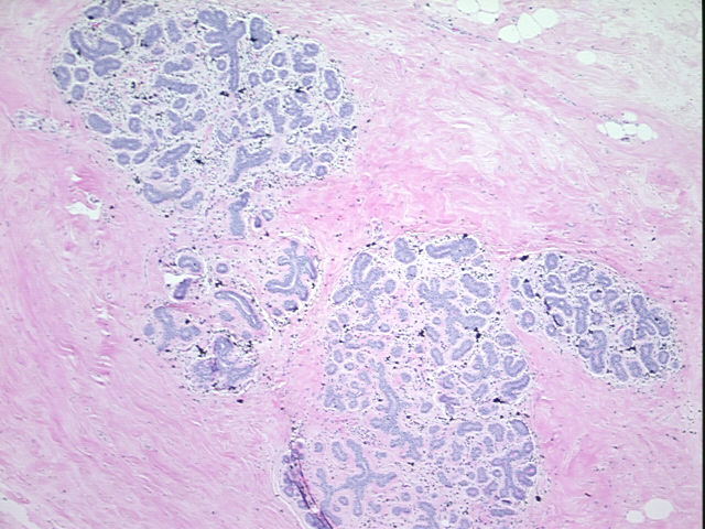 4x Image