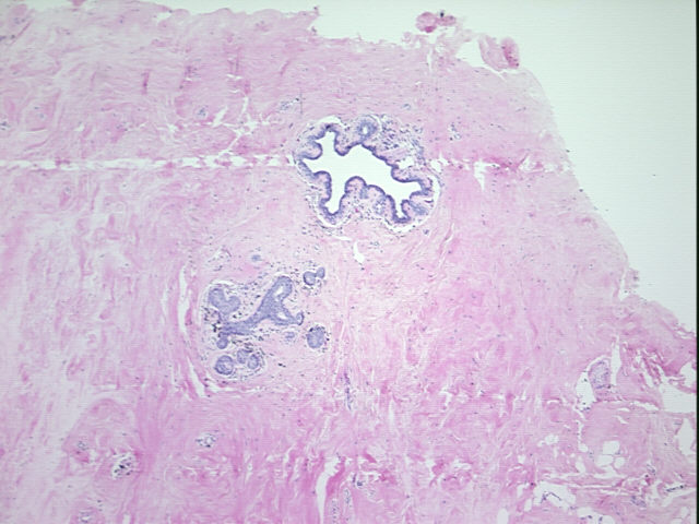 4x Image