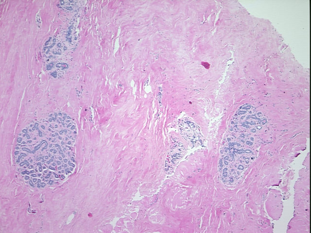 4x Image