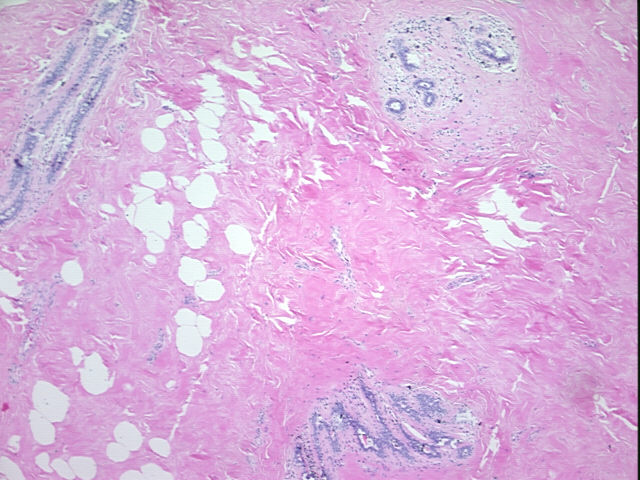4x Image