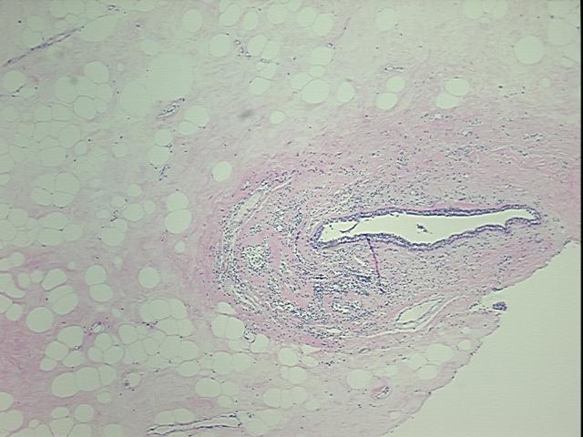 4x Image