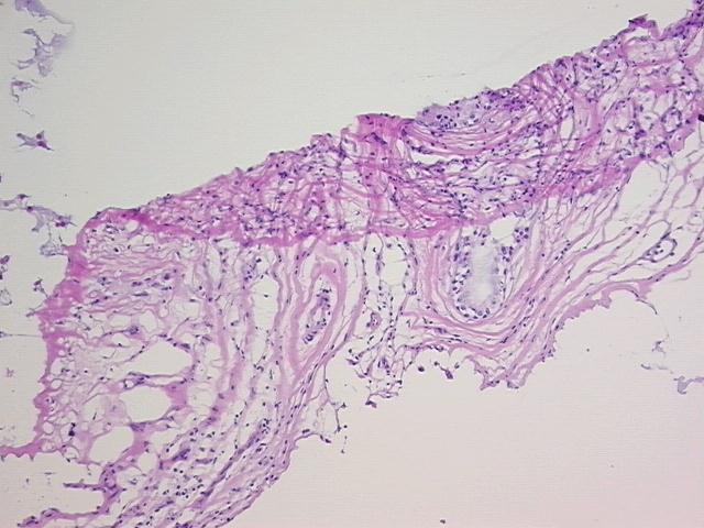 4x Image