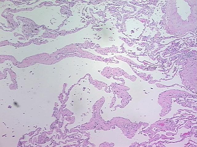4x Image