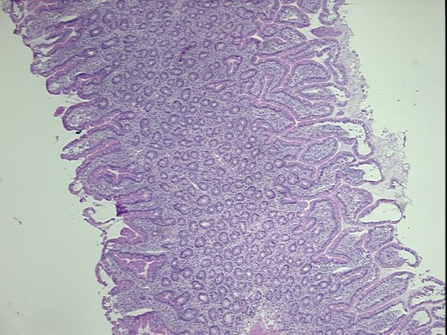 4x Image