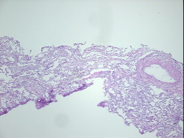 4x Image