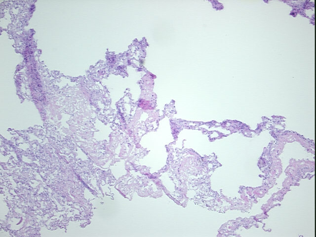 4x Image