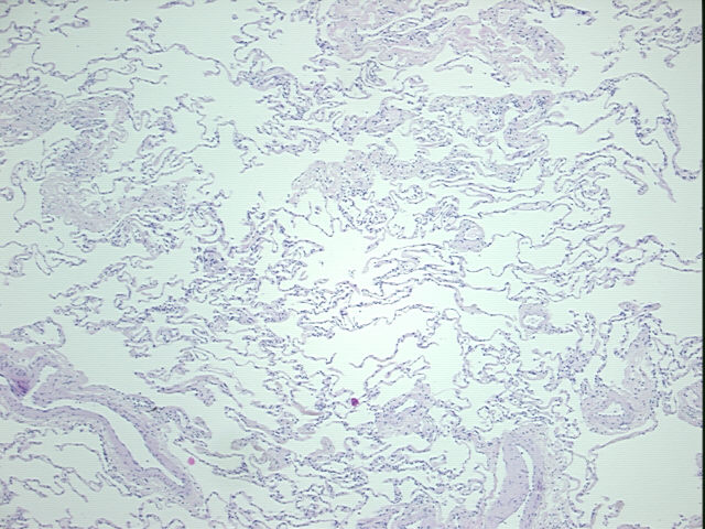 4x Image