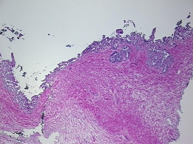 4x Image