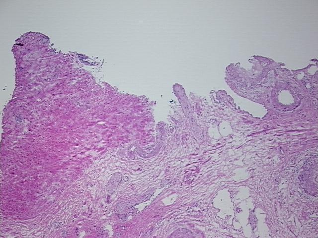 4x Image
