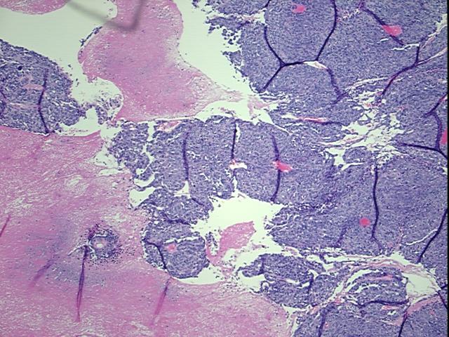 4x Image
