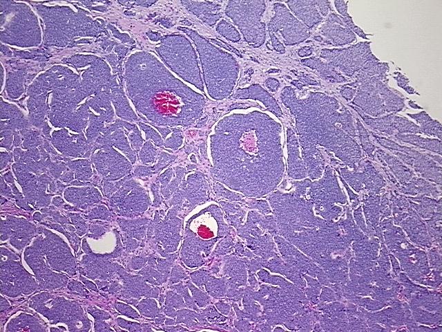 4x Image