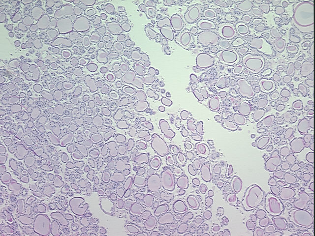 4x Image