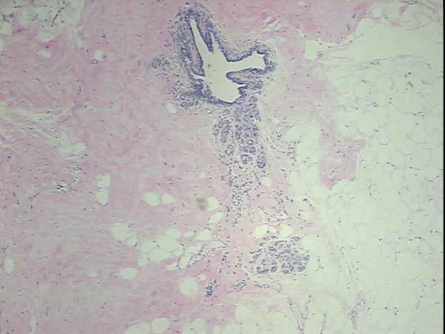 4x Image