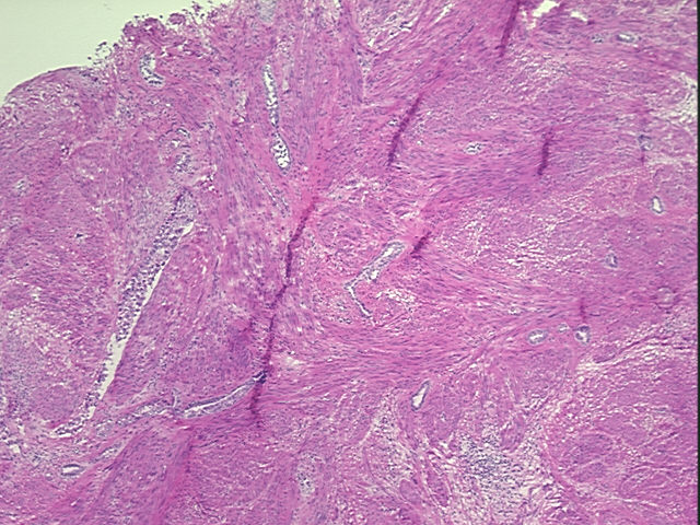 4x Image