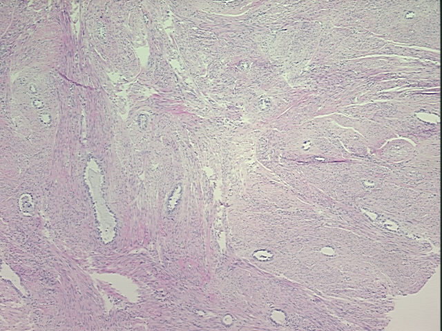 4x Image