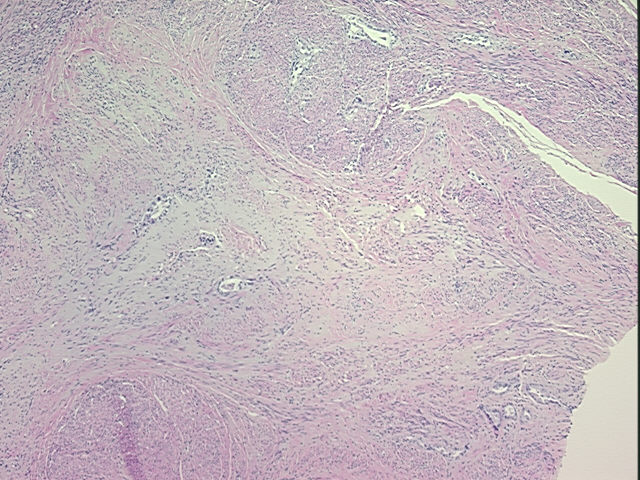 4x Image